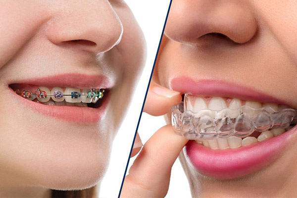 正畸正颌治疗的程序是什么样的