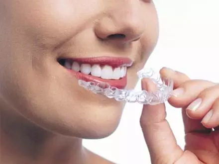 佩戴活动矫治器的注意事项