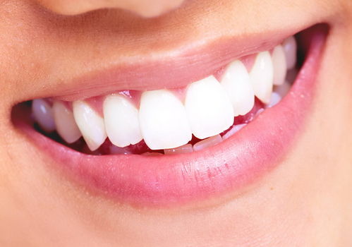 影响牙齿美丽的因素有哪些