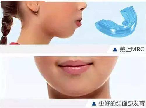 常见的矫治方法有哪些