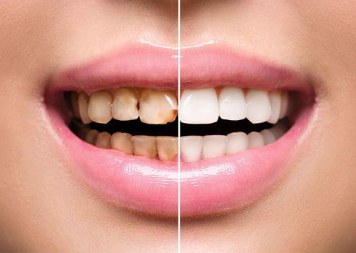 牙色异常的病因有哪些