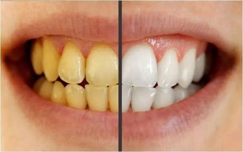 牙色异常的预防措施有哪些