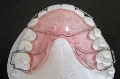 牙齿矫正后保持的原因是什么