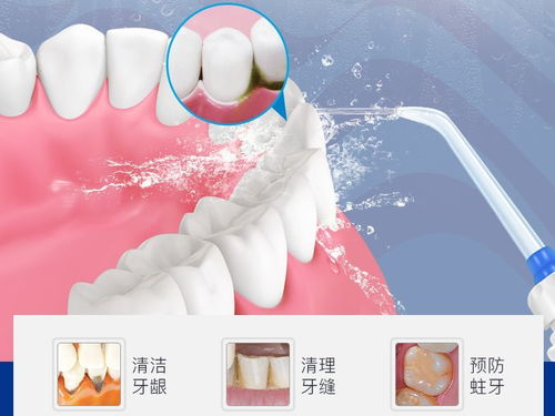 怎样“洗牙”才能洗出健康