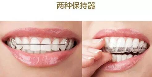 口腔正畸治疗后宜戴保持器