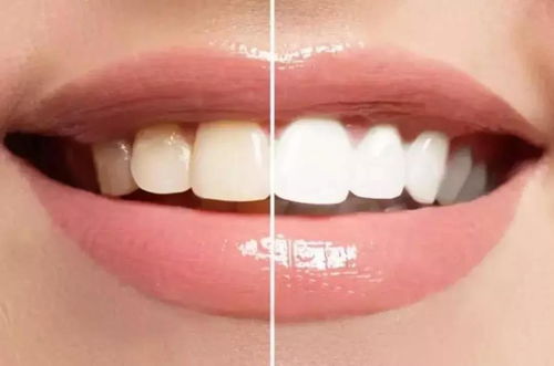 牙齿颜色异常的原因有哪些