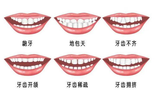 牙颌骑形什么时候矫正效果最好