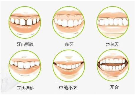 牙颌畸形是什么样的