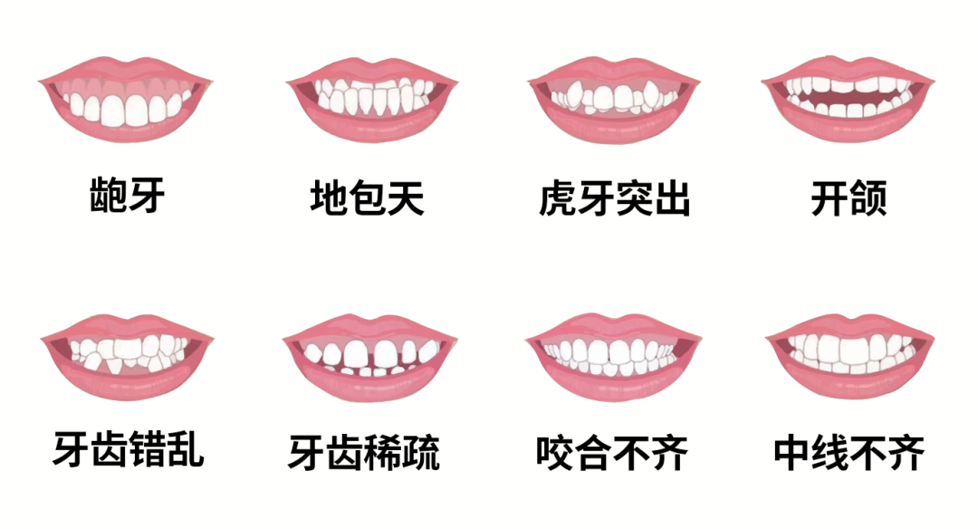 牙颌畸形什么年龄矫治最好