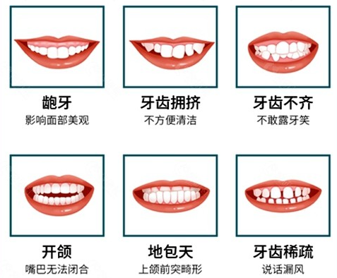 牙齿不整齐 不美观是病吗