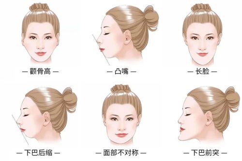 颌面部后天畸形的原因有哪些