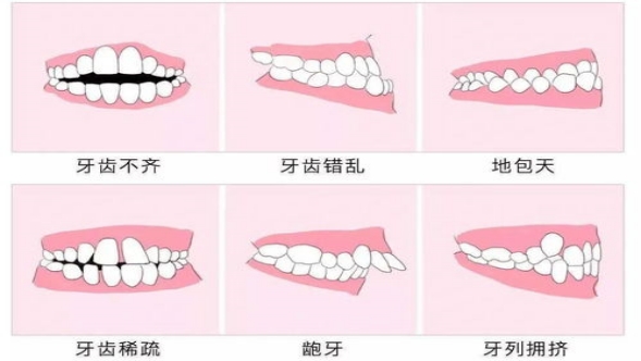 牙颌面畸形的病因是什么