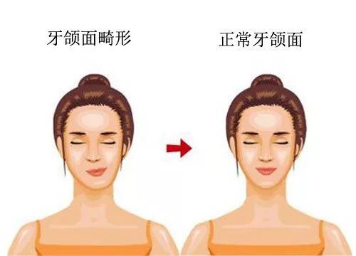 正常颌是什么样的