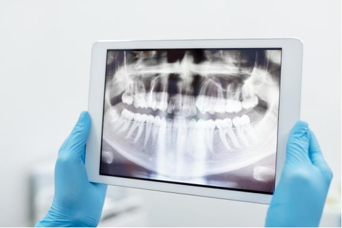 牙齿矫正的流程是什么