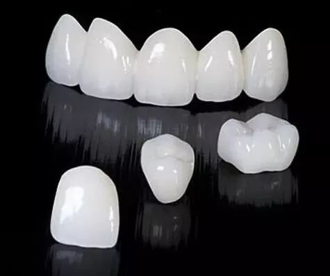 烤瓷牙固定修复的注意事项是什么