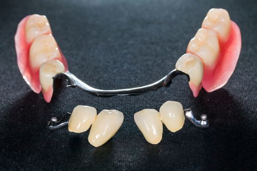 假牙需要修理与更换吗