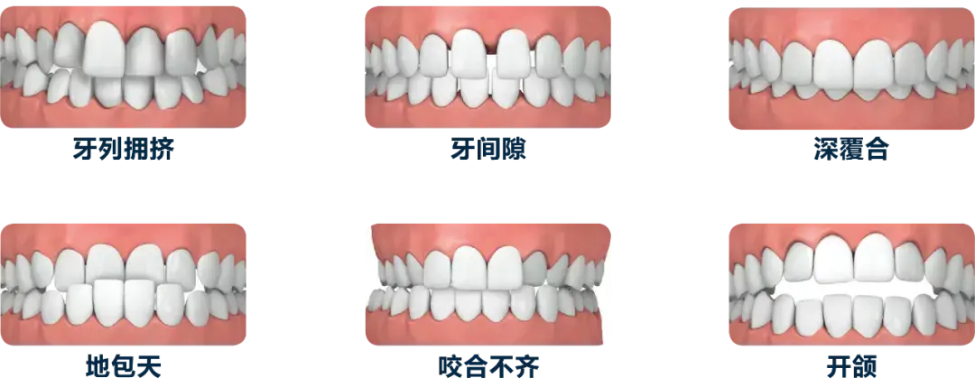 牙颌畸形的矫治目的是什么