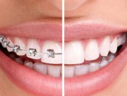 矫治后复发的因素与保持的时间