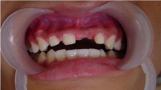 牙齿具有什么功能