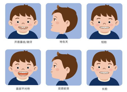 儿童口腔不良习惯与错颌畸形