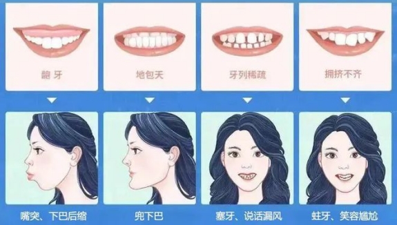 牙颌畸形形成的原因