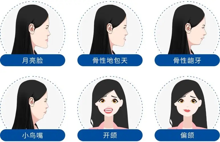 牙颌面畸形的分类及临床表现