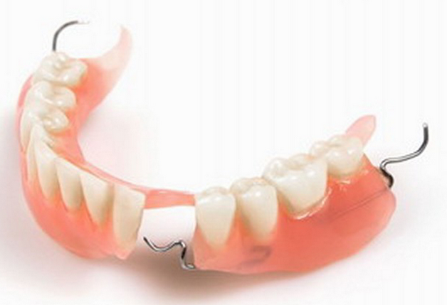 可摘部分义齿应达到的基本要求是什么