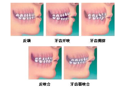 牙颌面畸形的治疗原则