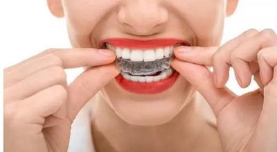 常州矫正牙齿要多少钱？35岁牙齿矫正会不会有后遗症？
