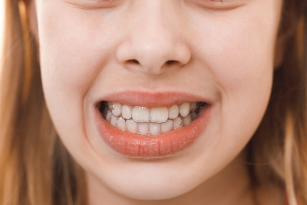 牙齿不整齐一定要矫正吗？在矫正牙齿的过程中疼不疼？