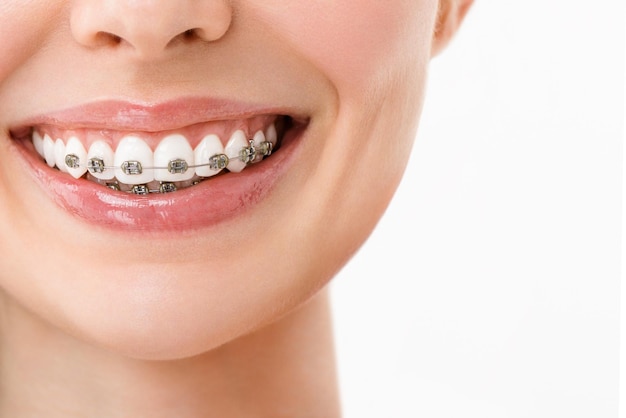 矫正牙齿一般要多长时间？矫正牙齿时间长短取决于什么？