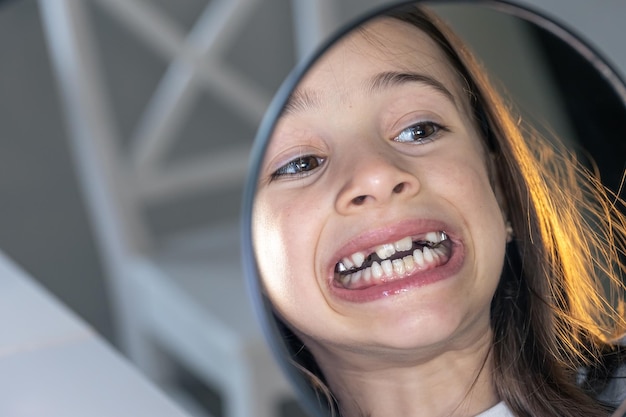 mrc牙齿矫正器价格，儿童牙齿没有换完可以矫正吗？