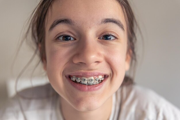 虎牙长在牙龈上可以牙齿矫正吗？哪种矫正器效果好？