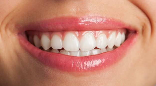 好的牙齿矫正是如何定义？矫正后生活和饮食有需要特别注意的吗？