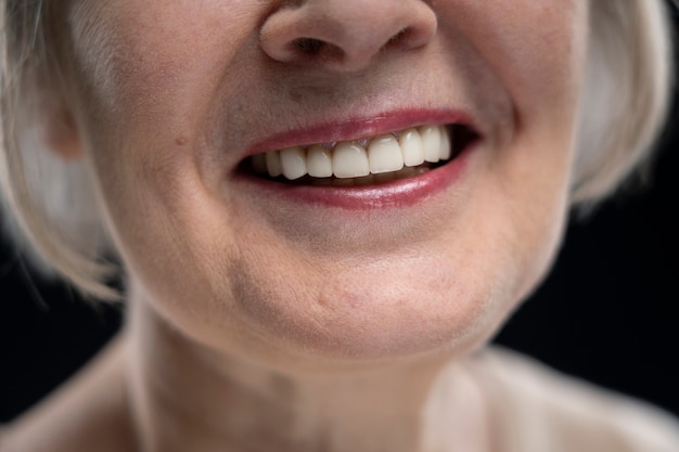 中年人牙齿正畸矫正费用，50岁做牙齿矫正有用吗，50岁还有必要做吗？