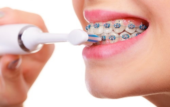 正畸小知识：在矫正过程中出现牙周炎应该如何治疗？