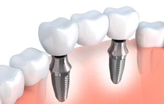 正规种植牙医院应该具备哪些条件？种植牙医生需要具备哪些资质？
