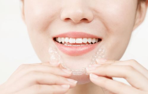 矫正牙齿怎么避免反弹？牙齿错位畸形怎么矫正？