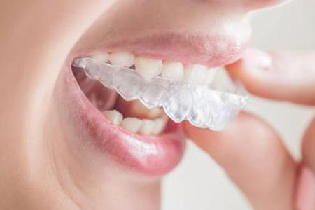 正畸后牙齿出现酸痛感正常吗？正畸后需要多久去医院复查一次？