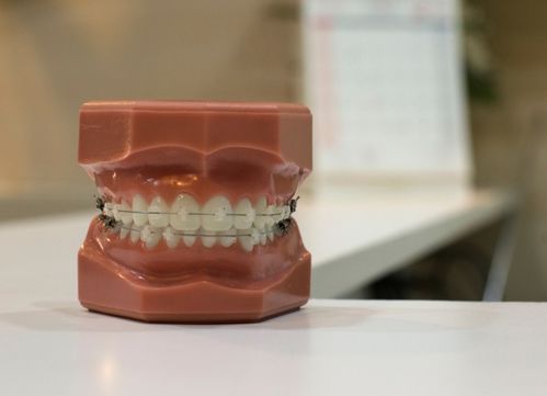 陶瓷牙套的优缺点有哪些？如何选择适合自己的陶瓷牙套？