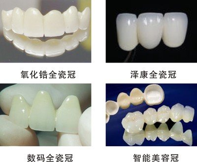 如何选择适合自己的全瓷牙修复方式？全瓷牙修复后怎么护理？