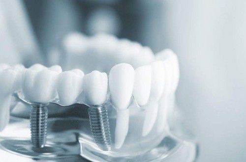 种牙小知识：牙槽骨条件差时，种植牙术后的风险有哪些？