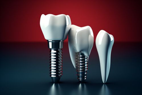 种植牙术后会痛多久？种植牙术后如何缓解疼痛？