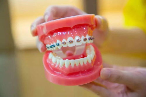 缺牙能做牙齿矫正吗？有智齿可以矫正牙齿吗？