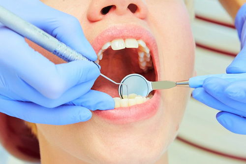 拔牙后感染了怎么办？怎么预防拔牙后出现感染？