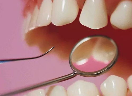 牙根拔除后如何缓解疼痛和肿胀？如何预防牙根拔除后感染？